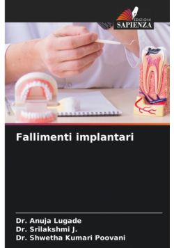 Fallimenti implantari