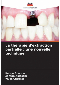 La thérapie d'extraction partielle