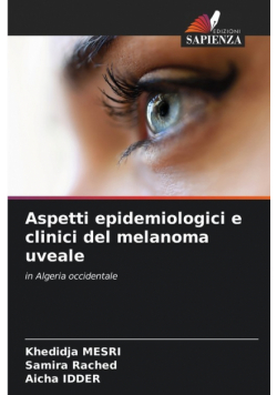 Aspetti epidemiologici e clinici del melanoma uveale