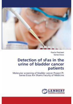 Detection of sFas in the urine of bladder cancer patients