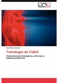 Tetralogia de Fallot
