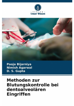 Methoden zur Blutungskontrolle bei dentoalveolären Eingriffen