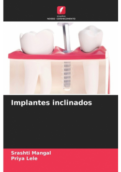 Implantes inclinados