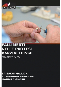 Fallimenti Nelle Protesi Parziali Fisse