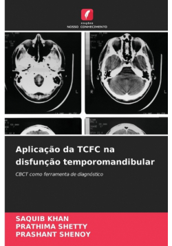 Aplicação da TCFC na disfunção temporomandibular