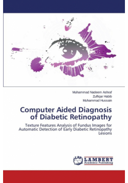 Computer Aided Diagnosis of Diabetic Retinopathy