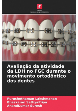 Avaliação da atividade da LDH no FGC durante o movimento ortodôntico dos dentes