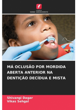 Má Oclusão Por Mordida Aberta Anterior Na Dentição Decídua E Mista