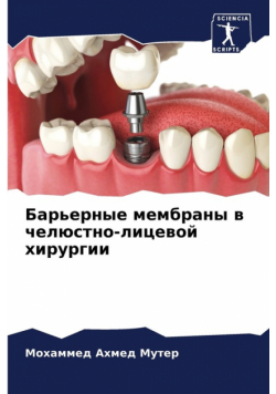 Барьерные мембраны в челюстно-лицевой хирургии