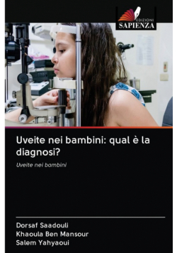 Uveite nei bambini
