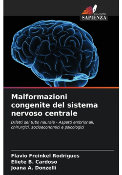 Malformazioni congenite del sistema nervoso centrale