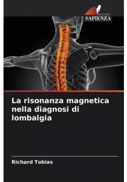 La risonanza magnetica nella diagnosi di lombalgia