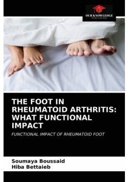 The Foot In Rheumatoid Arthritis