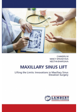 Maxillary Sinus Lift