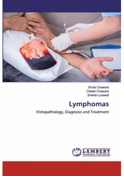 Lymphomas