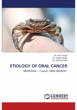 Etiology of Oral Cancer