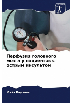 Перфузия головного мозга у пациентов с острым инсультом