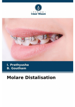 Molare Distalisation