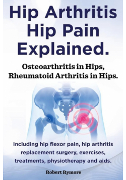 Hip Arthritis, Hip Pain Explained. Osteoarthritis in Hips, Rheumatoid Arthritis in Hips. Including Hip Arthritis Surgery, Hip Flexor Pain, Exercises,