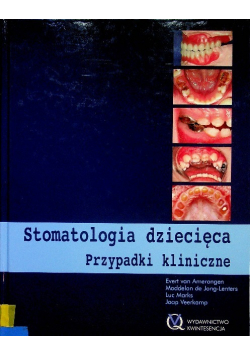 Stomatologia Dziecięca Przypadki Kliniczne
