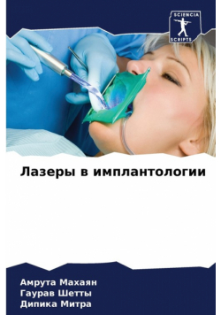 Лазеры в имплантологии