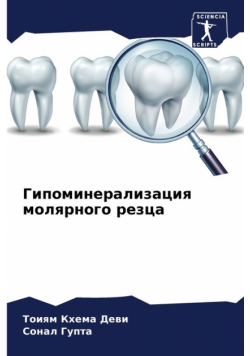 Гипоминерализация молярного резца