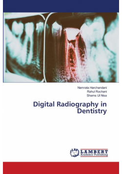 Digital Radiography in Dentistry