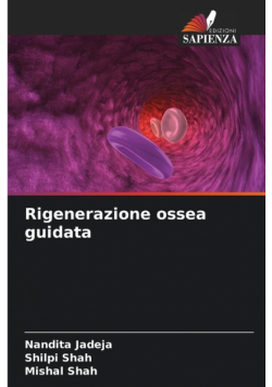 Rigenerazione ossea guidata