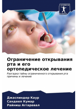 Ограничение открывания рта и его ортопедическое лечение