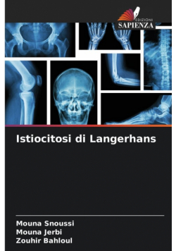 Istiocitosi di Langerhans