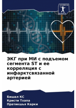 Экг При Ми С Подъемом Сегмента St И Ее Корреляция С Инфарктсвязанной Артерией
