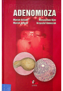 Adenomioza