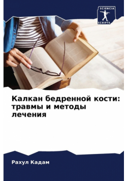 Калкан бедренной кости