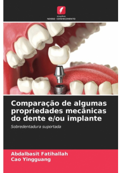Comparação de algumas propriedades mecânicas do dente e/ou implante