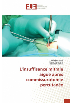 L'insuffisance mitrale aigue après commissurotomie percutanée