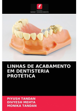 Linhas De Acabamento Em Dentisteria Protética