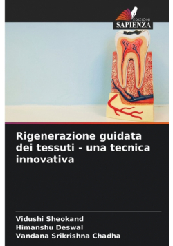 Rigenerazione guidata dei tessuti - una tecnica innovativa
