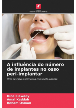 A influência do número de implantes no osso peri-implantar
