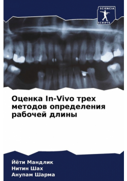 Оценка In-Vivo трех методов определения рабочей длины