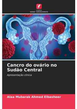 Cancro do ovário no Sudão Central