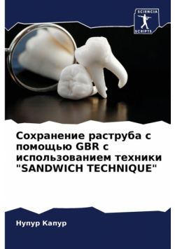 Сохранение Раструба С Помощью Gbr С Использованием Техники "sandwich Technique"