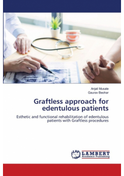 Graftless approach for edentulous patients