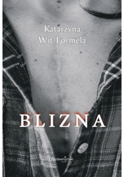 Blizna
