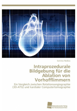 Intraprozedurale Bildgebung für die Ablation von Vorhofflimmern
