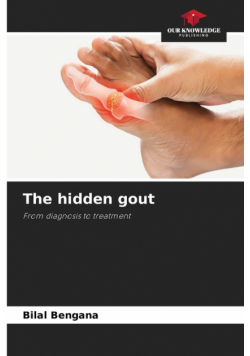 The hidden gout