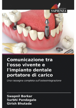 Comunicazione tra l'osso vivente e l'impianto dentale portatore di carico