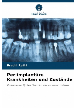 Periimplantäre Krankheiten und Zustände