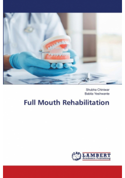 Full Mouth Rehabilitation