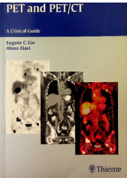 Pet And Pet/ct