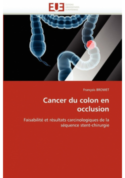 Cancer du colon en occlusion